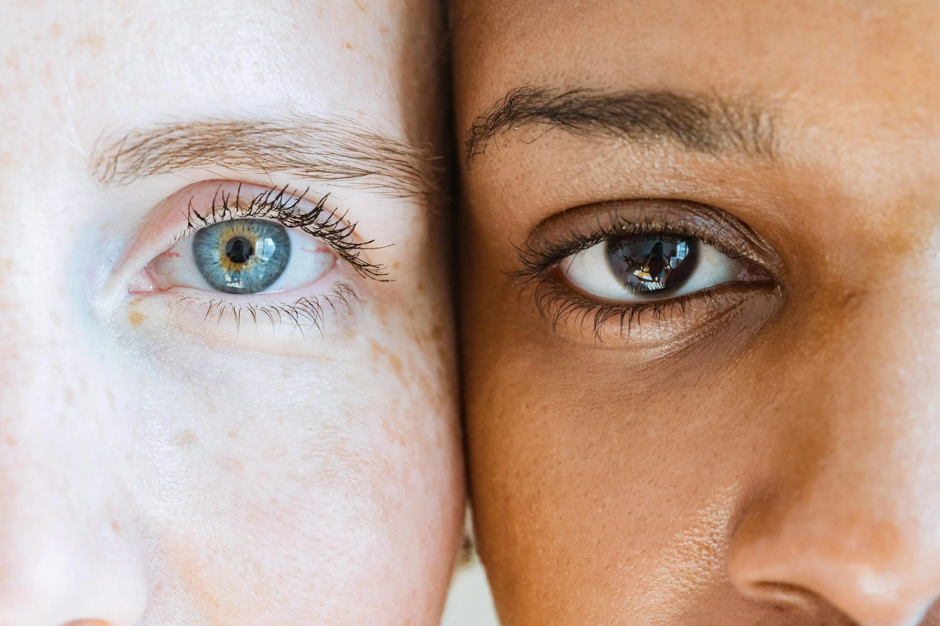 Different Skin Types & How to Care for Them Ae Botanicals